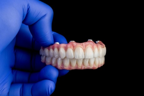 Illustration of gloved hands holding implant dentures