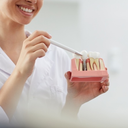 Female dentist pointing to model of dental implant