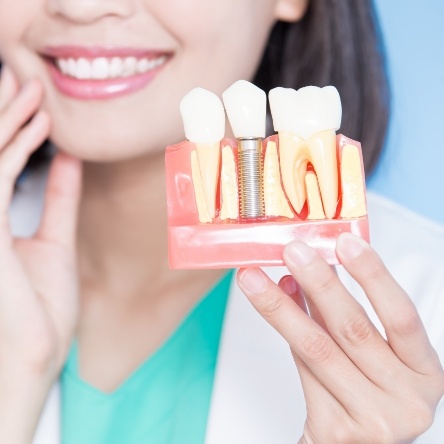 Dentist holding up model of dental implant