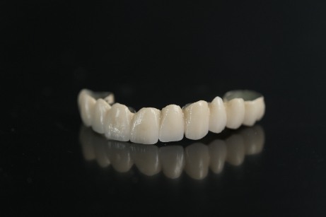 Row of artificial teeth sitting on black background