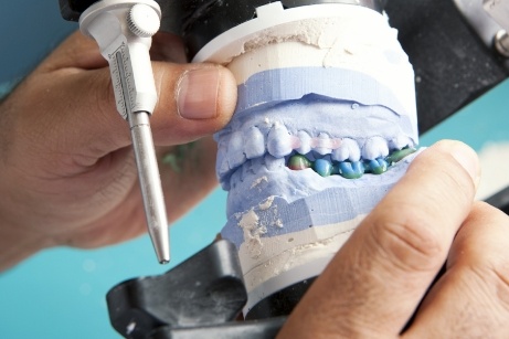 Device being used to create dentures