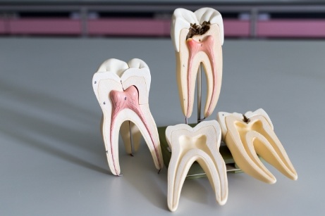 Multiple models of inside of teeth
