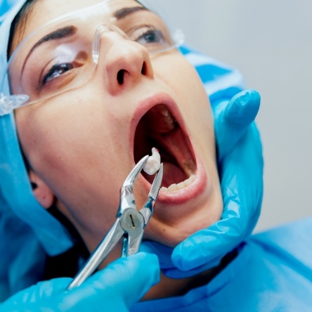 Holding mouth open while tooth is removed