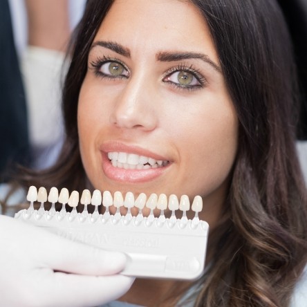Color matching womans smile for veneers