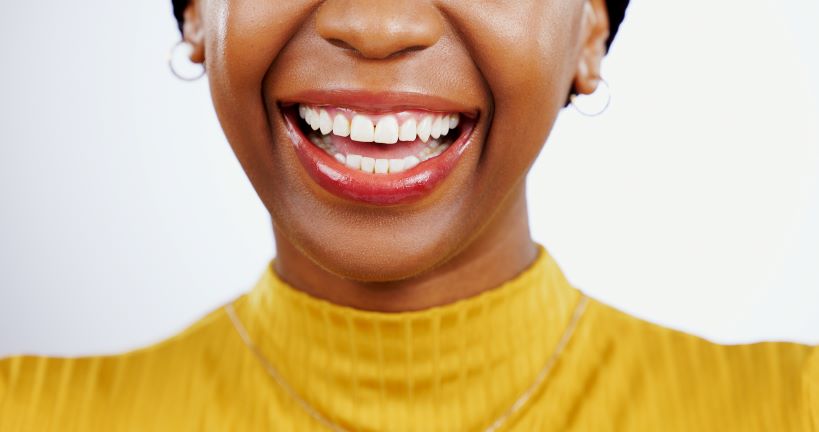 A closeup of a smiling woman's teeth.